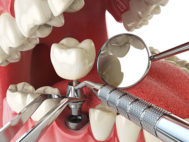 Best Emergency Dental Care for Sports Injuries in Vance, AL